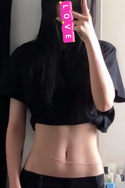 なな 1